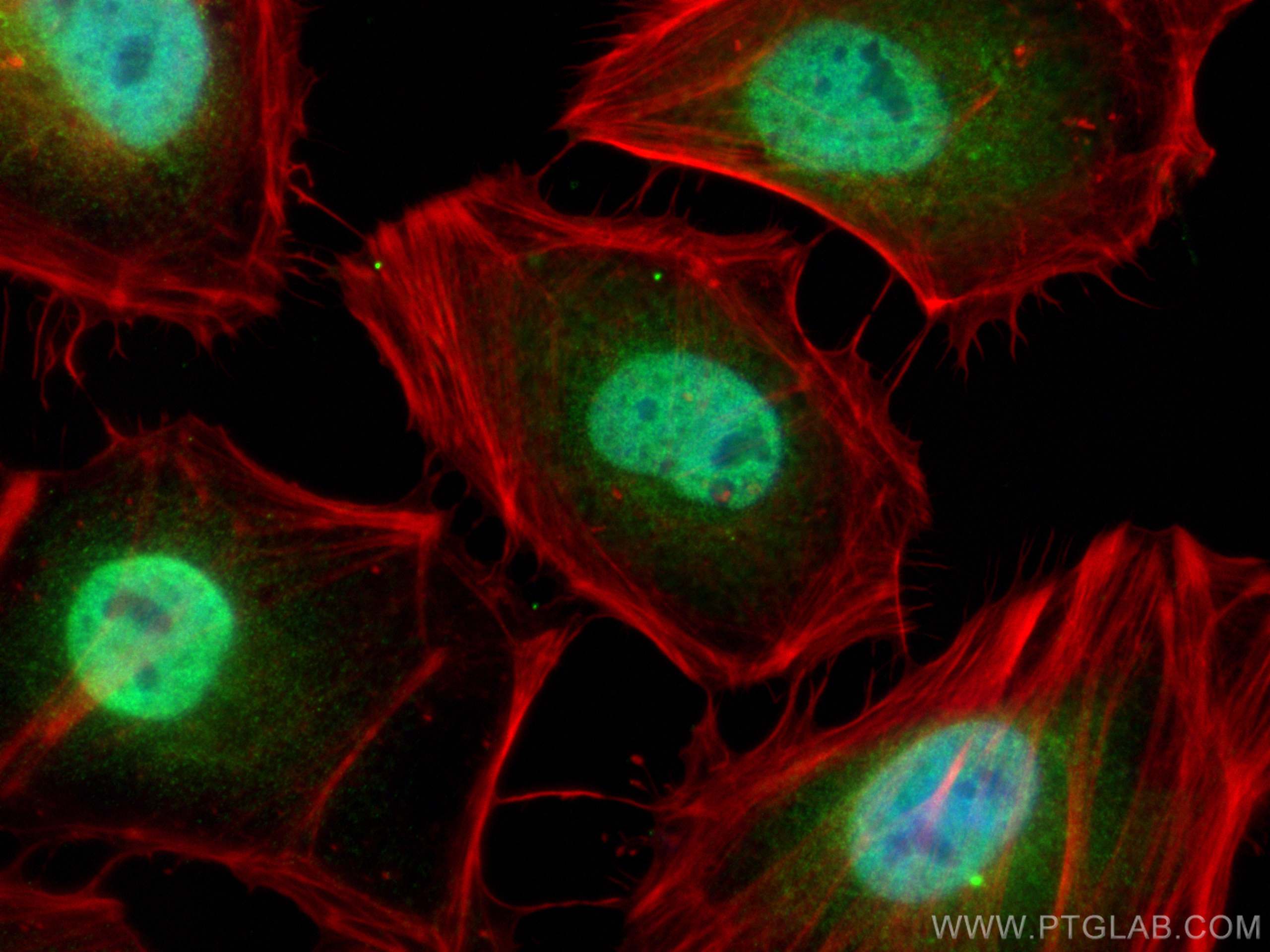 Immunofluorescence (IF) / fluorescent staining of HeLa cells using HP1BP3 Polyclonal antibody (24556-1-AP)