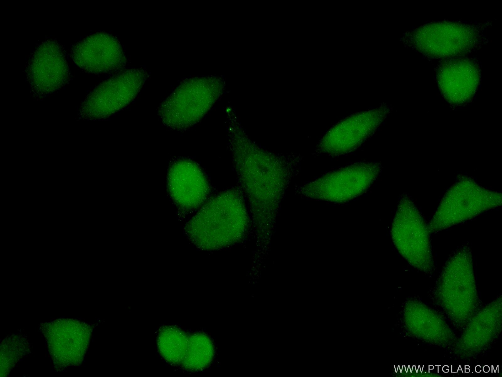 Immunofluorescence (IF) / fluorescent staining of HeLa cells using HP1BP3 Polyclonal antibody (24556-1-AP)