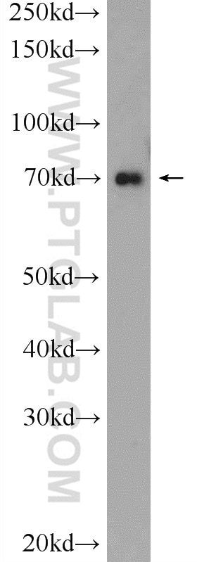 Western Blot (WB) analysis of HeLa cells using HP1BP3 Polyclonal antibody (24556-1-AP)