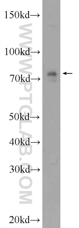 Western Blot (WB) analysis of MCF-7 cells using HP1BP3 Polyclonal antibody (24556-1-AP)