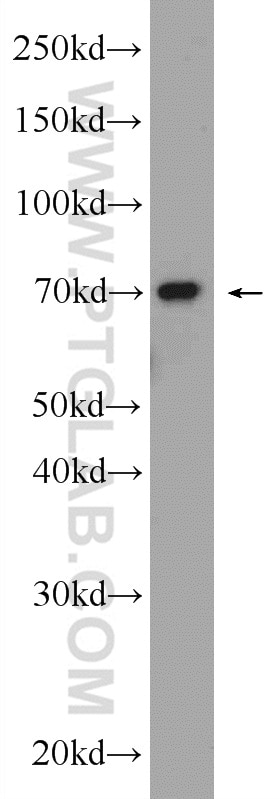 Western Blot (WB) analysis of mouse thymus tissue using HP1BP3 Polyclonal antibody (24556-1-AP)