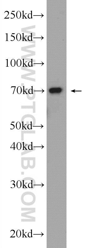 Western Blot (WB) analysis of mouse thymus tissue using HP1BP3 Polyclonal antibody (24556-1-AP)