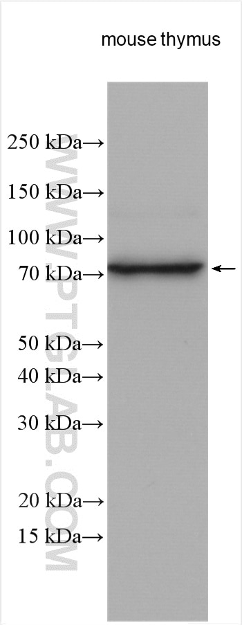 Western Blot (WB) analysis of various lysates using HP1BP3 Polyclonal antibody (24556-1-AP)