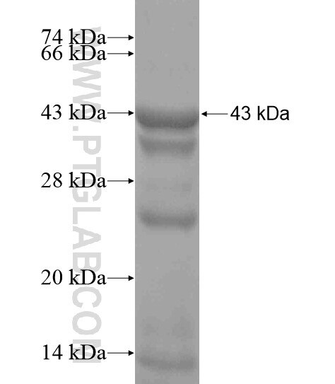 HP1BP3 fusion protein Ag18709 SDS-PAGE