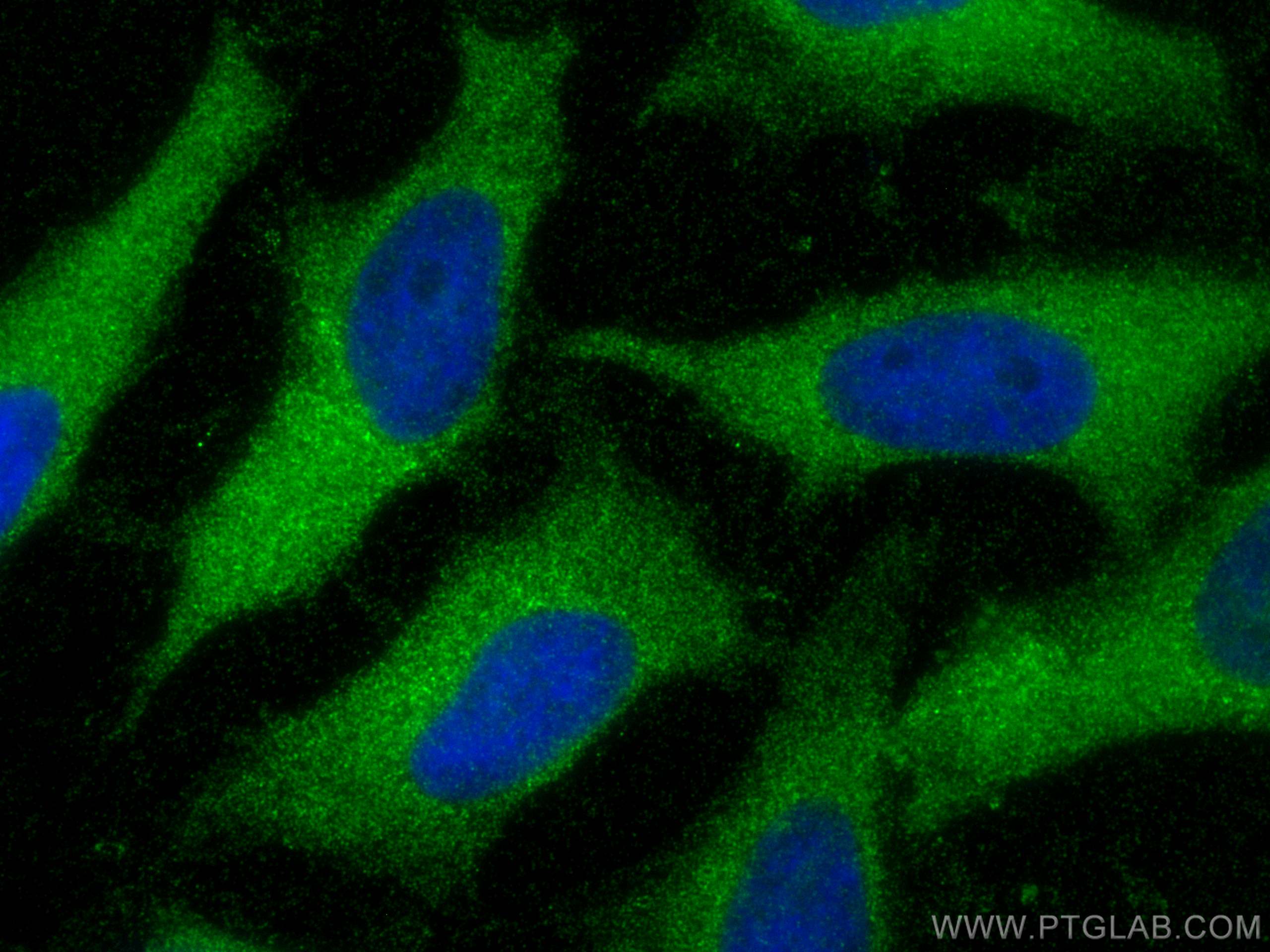 Immunofluorescence (IF) / fluorescent staining of HeLa cells using VILIP3 Polyclonal antibody (10989-1-AP)