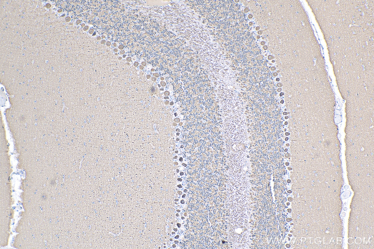 Immunohistochemistry (IHC) staining of mouse cerebellum tissue using VILIP3 Polyclonal antibody (10989-1-AP)