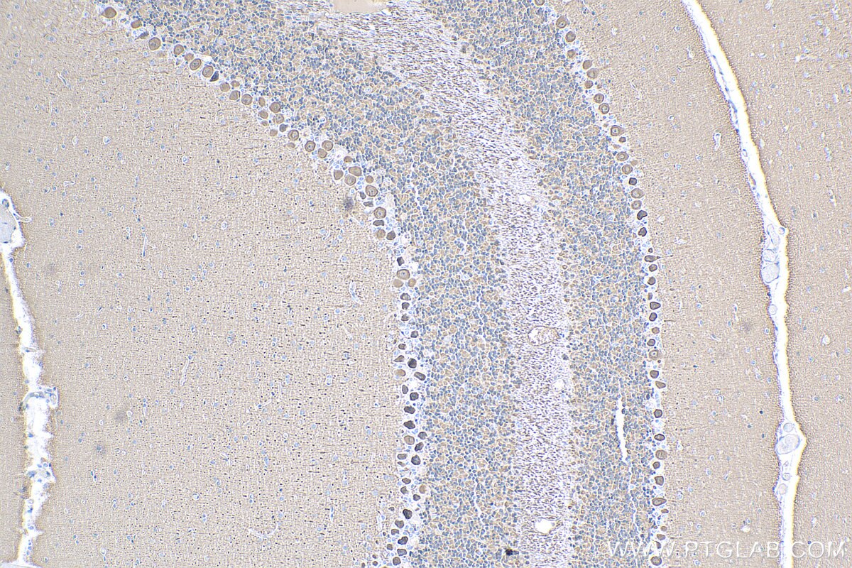 IHC staining of mouse cerebellum using 10989-1-AP