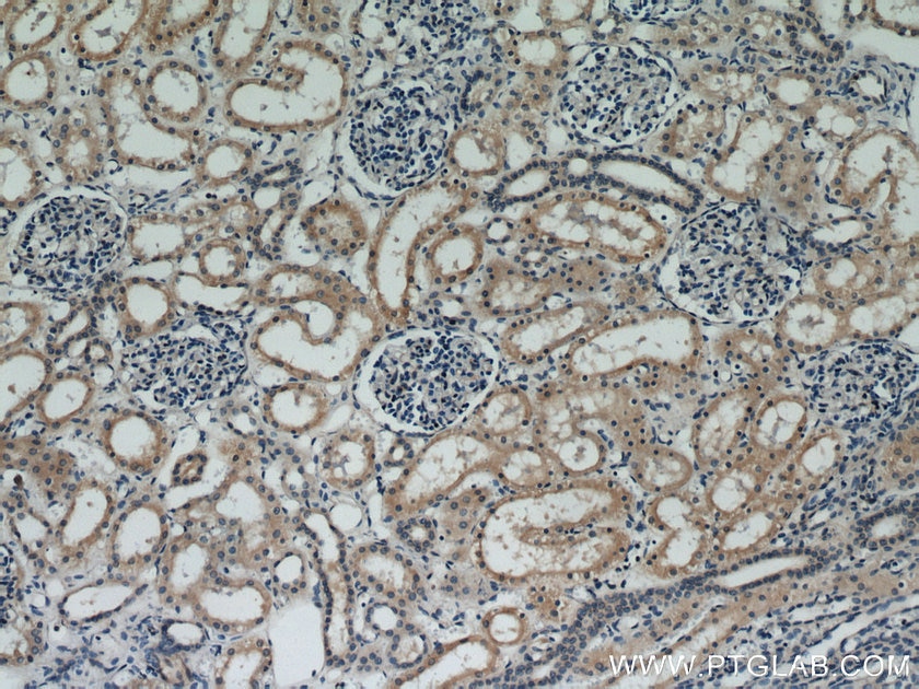 Immunohistochemistry (IHC) staining of human kidney tissue using VILIP3 Polyclonal antibody (10989-1-AP)