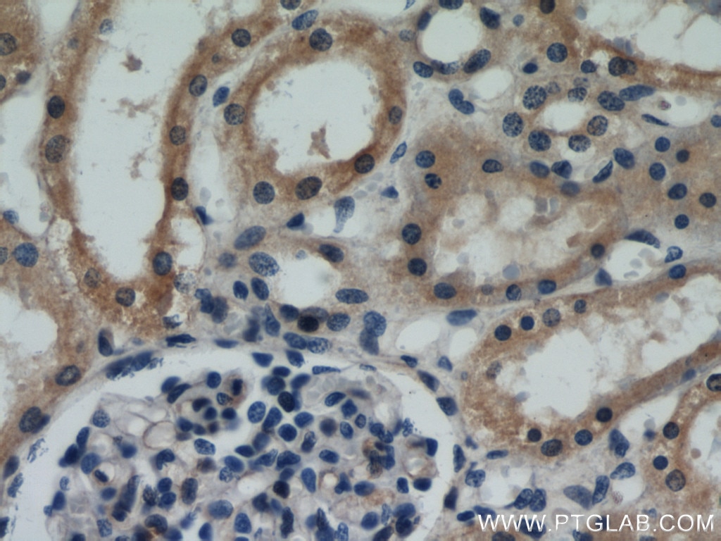 Immunohistochemistry (IHC) staining of human kidney tissue using VILIP3 Polyclonal antibody (10989-1-AP)