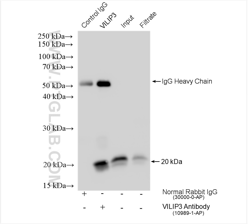 Immunoprecipitation (IP) experiment of mouse brain tissue using VILIP3 Polyclonal antibody (10989-1-AP)
