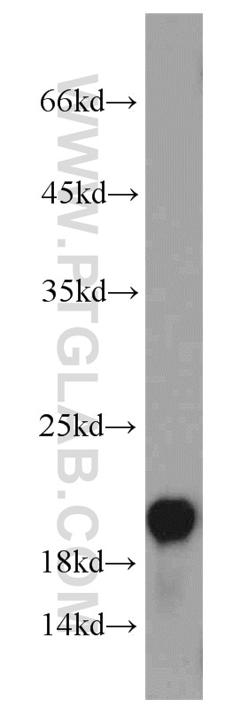 Western Blot (WB) analysis of HeLa cells using VILIP3 Polyclonal antibody (10989-1-AP)