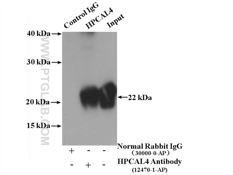 Immunoprecipitation (IP) experiment of fetal human brain tissue using HPCAL4 Polyclonal antibody (12470-1-AP)