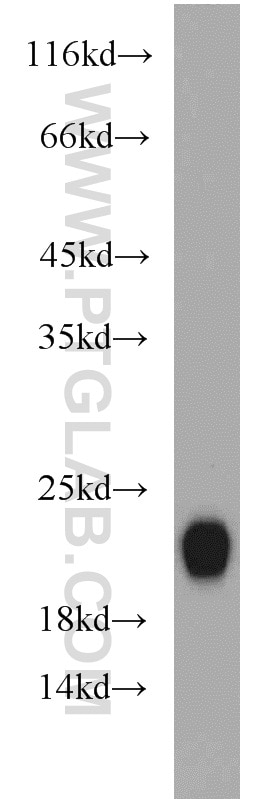 Western Blot (WB) analysis of human brain tissue using HPCAL4 Polyclonal antibody (12470-1-AP)