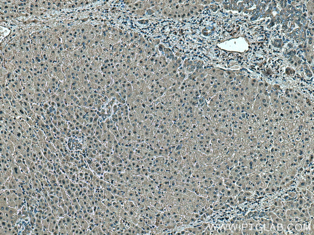 Immunohistochemistry (IHC) staining of human liver tissue using HPD Polyclonal antibody (17004-1-AP)