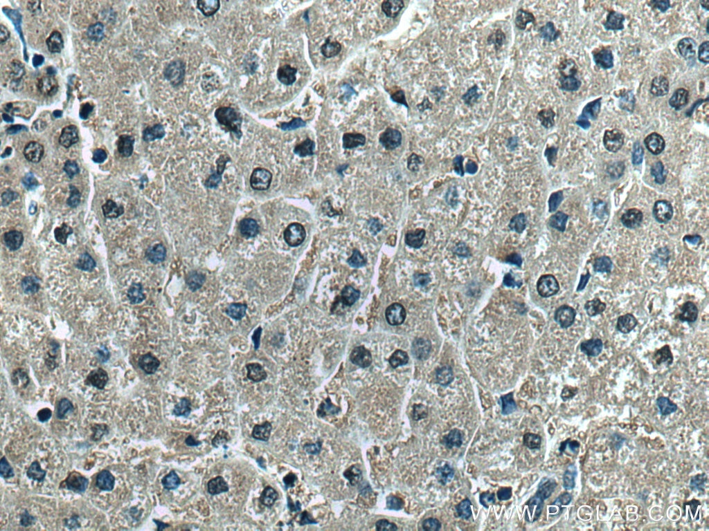 Immunohistochemistry (IHC) staining of human liver tissue using HPD Polyclonal antibody (17004-1-AP)