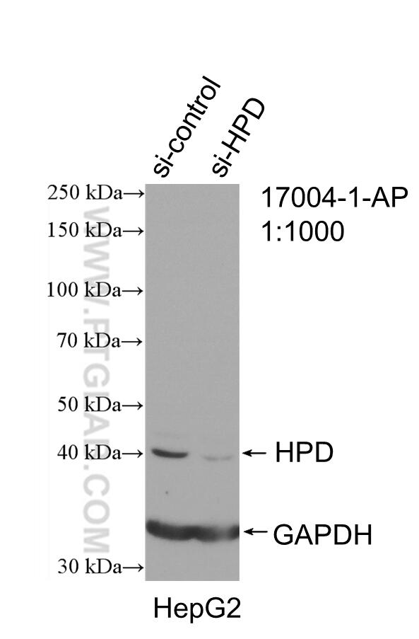 Western Blot (WB) analysis of HepG2 cells using HPD Polyclonal antibody (17004-1-AP)