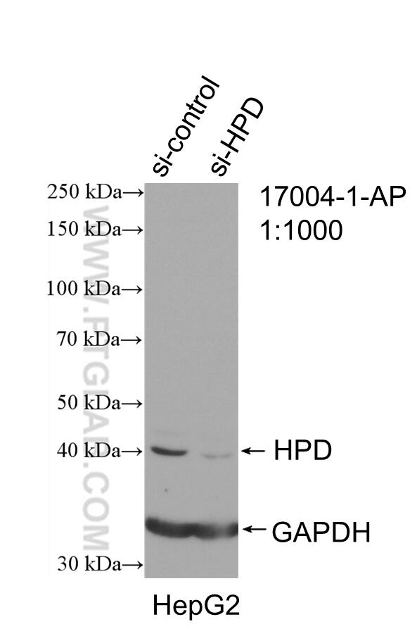 WB analysis of HepG2 using 17004-1-AP