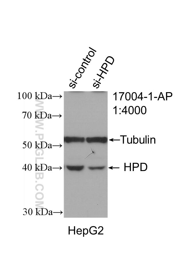 Western Blot (WB) analysis of HepG2 cells using HPD Polyclonal antibody (17004-1-AP)