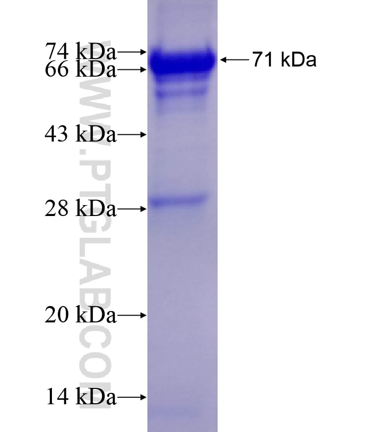 HPD fusion protein Ag10700 SDS-PAGE