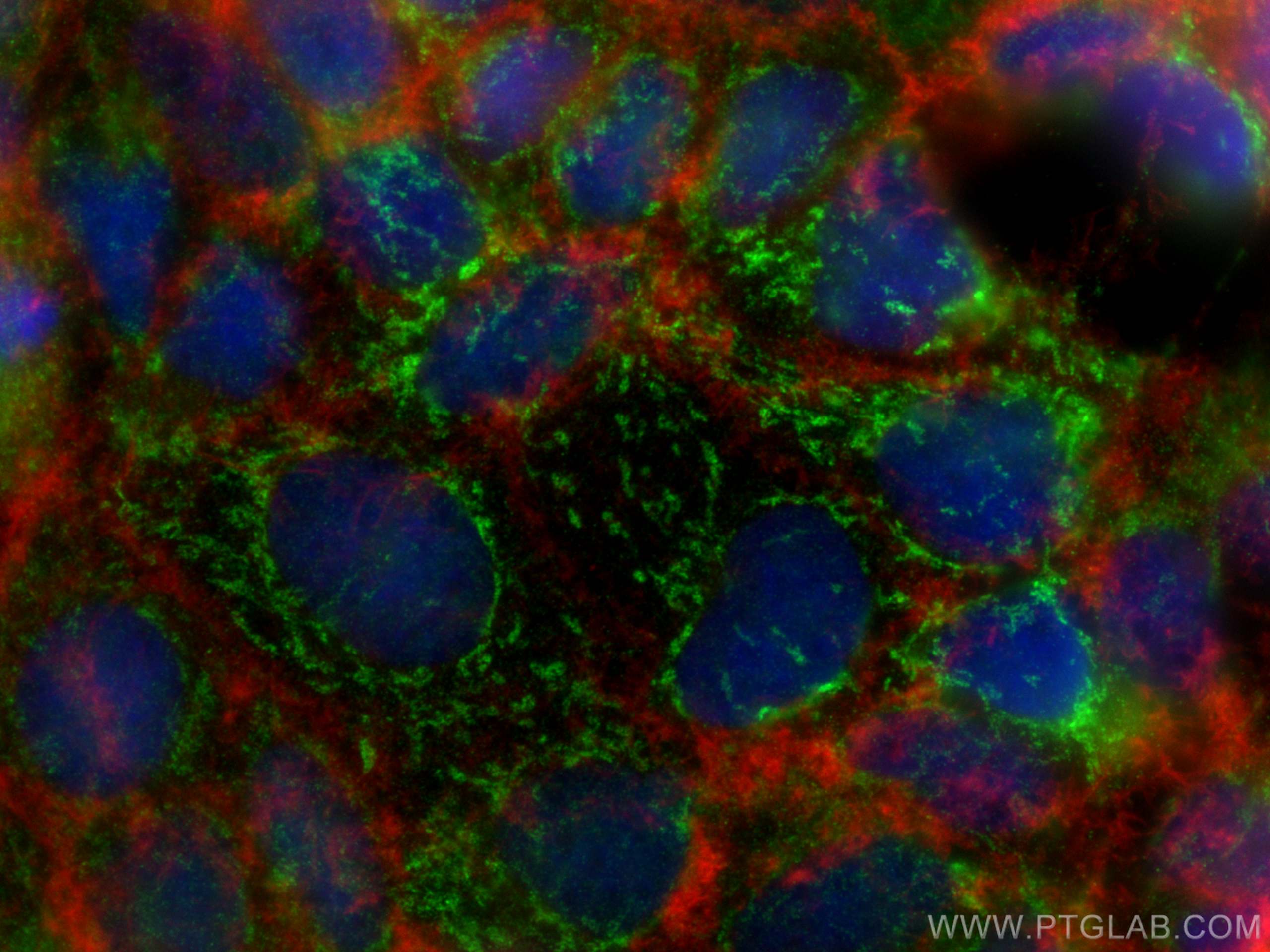Immunofluorescence (IF) / fluorescent staining of Caco-2 cells using HPDL Polyclonal antibody (20777-1-AP)