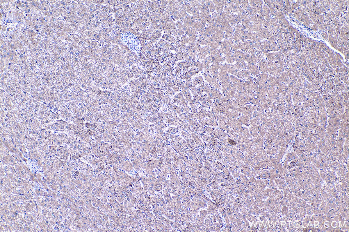 Immunohistochemistry (IHC) staining of human liver tissue using HPDL Polyclonal antibody (20777-1-AP)