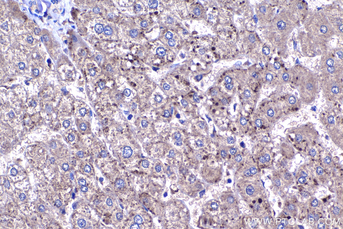 Immunohistochemistry (IHC) staining of human liver tissue using HPDL Polyclonal antibody (20777-1-AP)