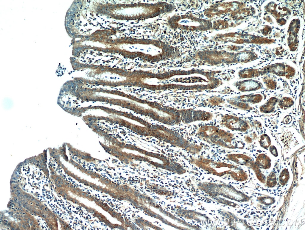 Immunohistochemistry (IHC) staining of human stomach tissue using HPDL Polyclonal antibody (20777-1-AP)