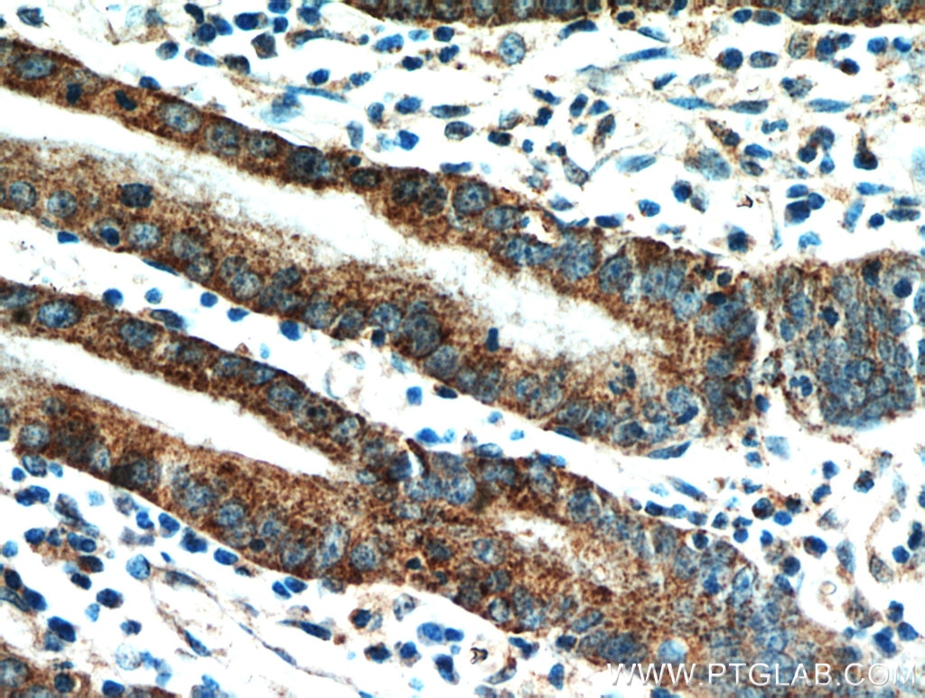 Immunohistochemistry (IHC) staining of human stomach tissue using HPDL Polyclonal antibody (20777-1-AP)