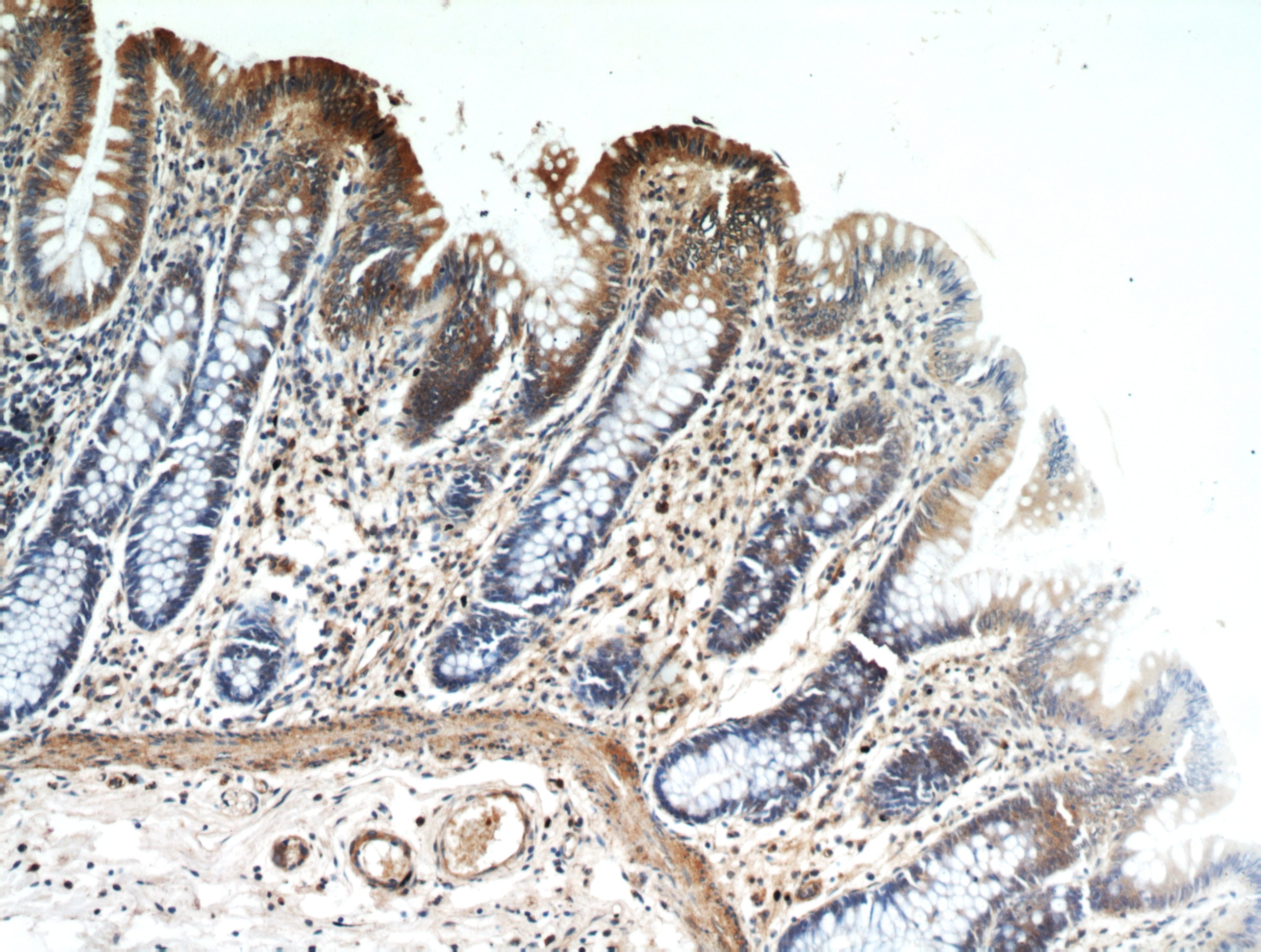 Immunohistochemistry (IHC) staining of human colon tissue using HPDL Polyclonal antibody (20777-1-AP)