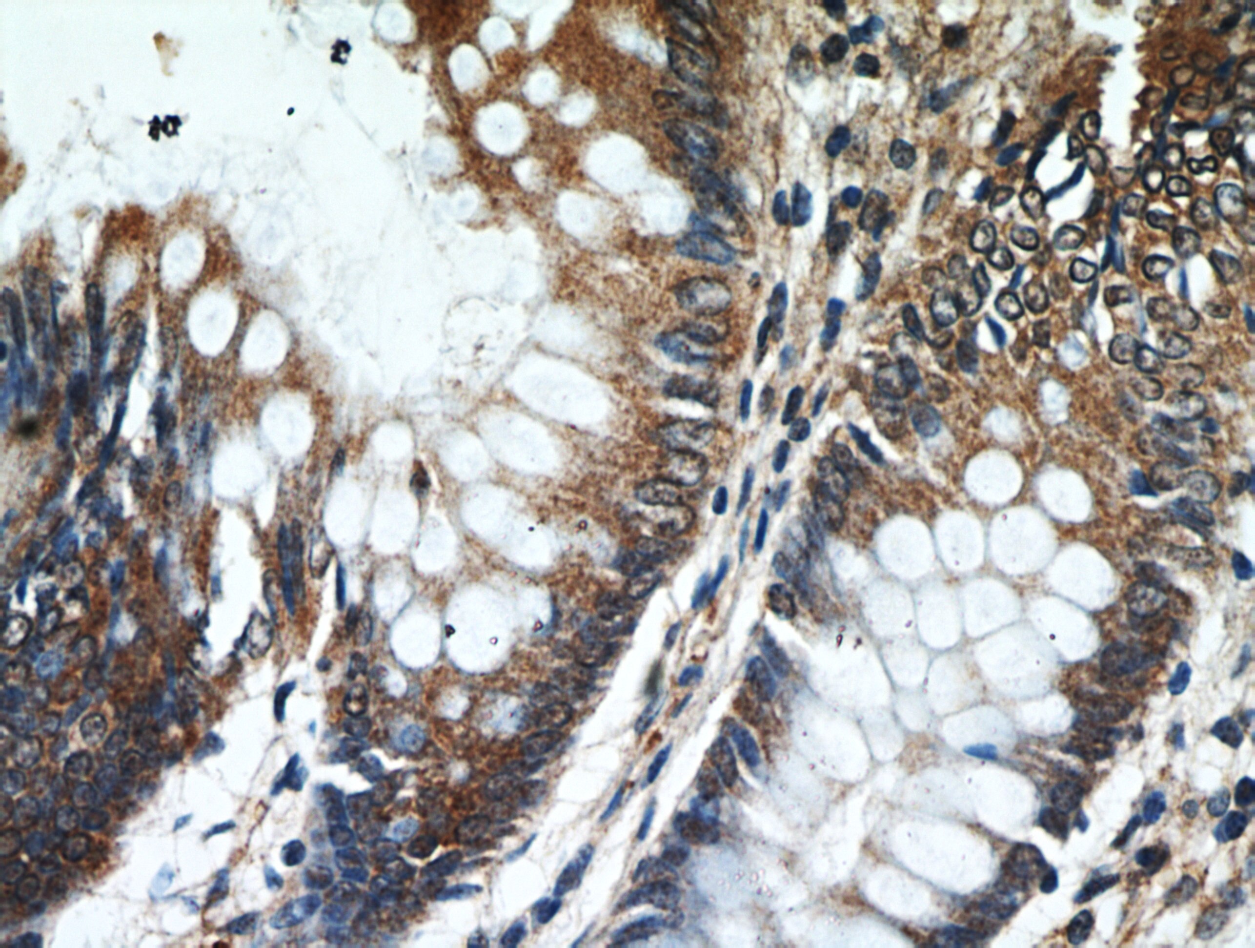 Immunohistochemistry (IHC) staining of human colon tissue using HPDL Polyclonal antibody (20777-1-AP)