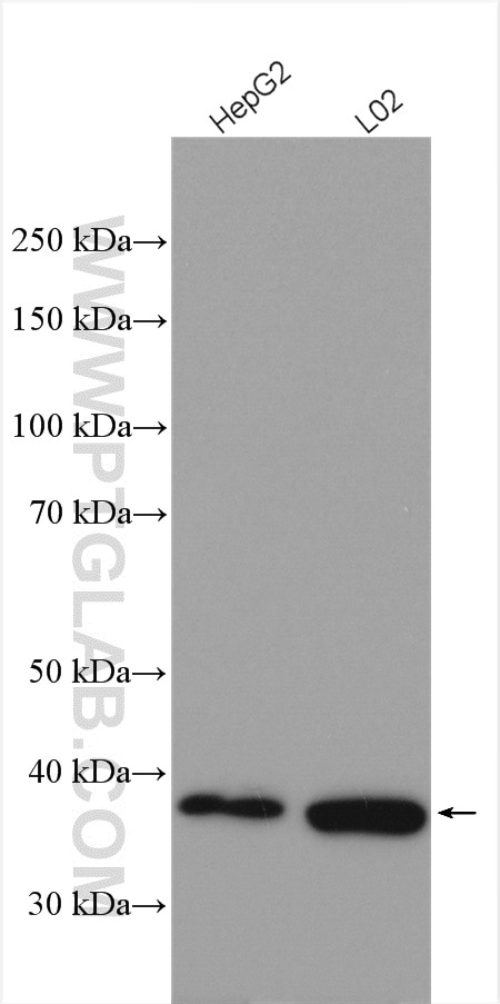 Western Blot (WB) analysis of various lysates using HPDL Polyclonal antibody (20777-1-AP)