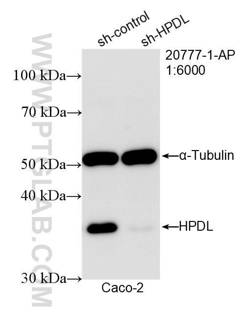 Western Blot (WB) analysis of Caco-2 cells using HPDL Polyclonal antibody (20777-1-AP)