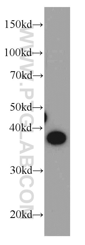 Western Blot (WB) analysis of L02 cells using HPDL Polyclonal antibody (20777-1-AP)