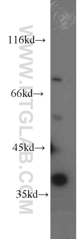 Western Blot (WB) analysis of L02 cells using HPDL Polyclonal antibody (20777-1-AP)