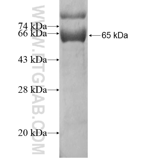 HPDL fusion protein Ag14773 SDS-PAGE