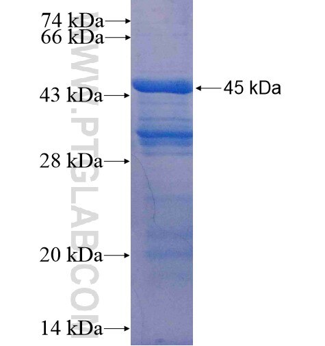 HPDL fusion protein Ag15637 SDS-PAGE