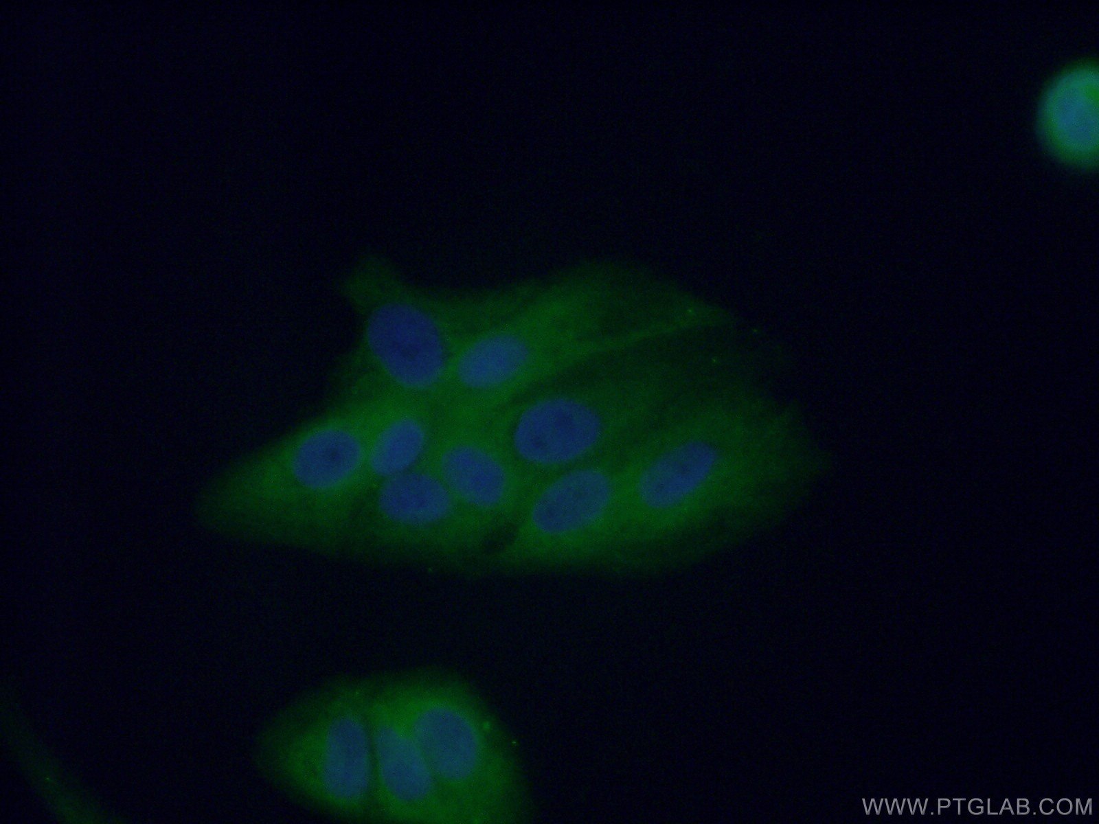 Immunofluorescence (IF) / fluorescent staining of A549 cells using HPGD Polyclonal antibody (11035-1-AP)