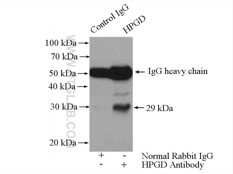 Immunoprecipitation (IP) experiment of human placenta tissue using HPGD Polyclonal antibody (11035-1-AP)