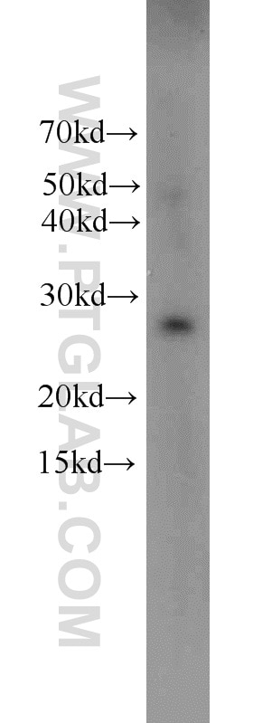Western Blot (WB) analysis of human placenta tissue using HPGD Polyclonal antibody (11035-1-AP)