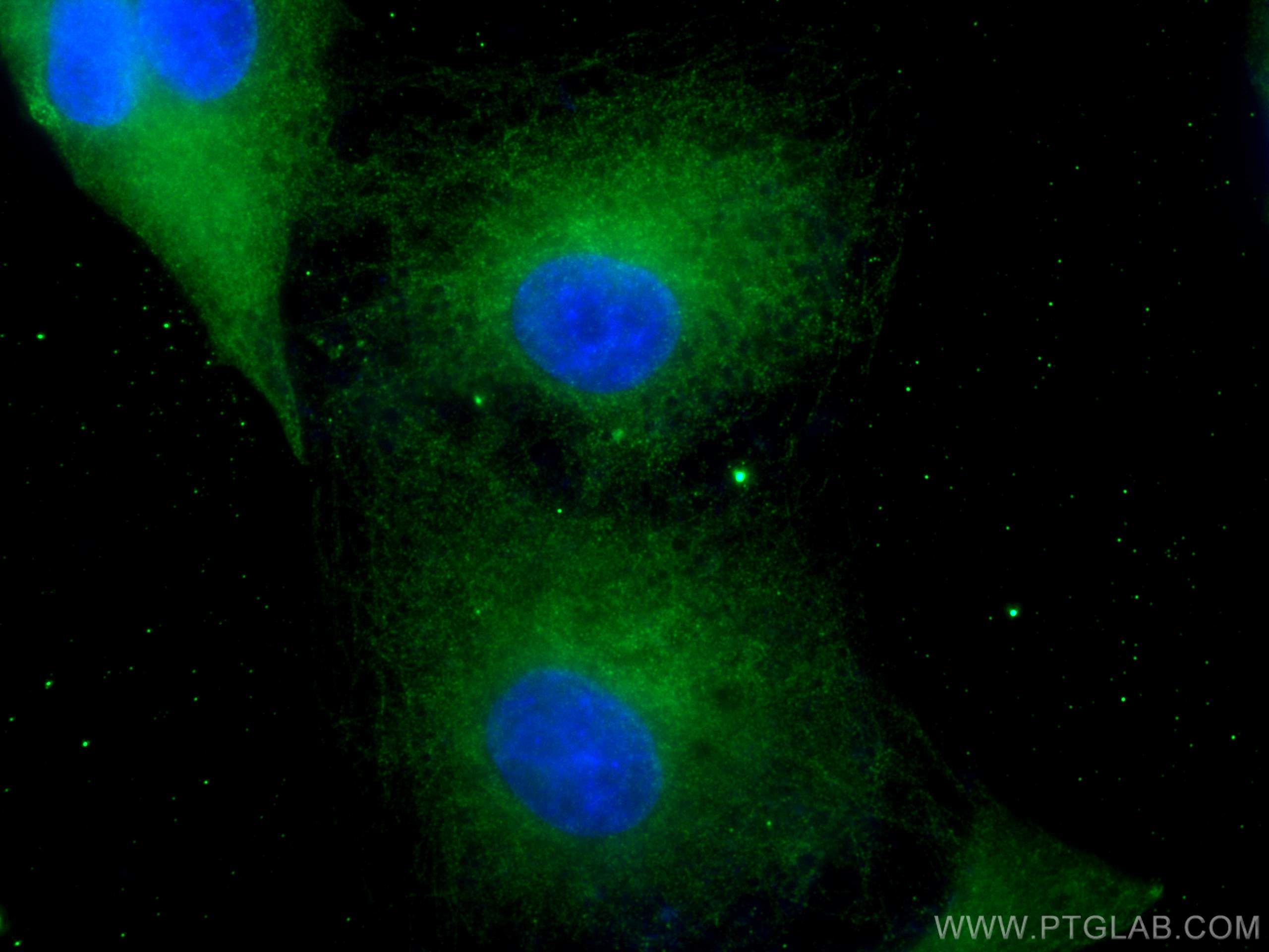 Immunofluorescence (IF) / fluorescent staining of A549 cells using HPGD Monoclonal antibody (66798-1-Ig)