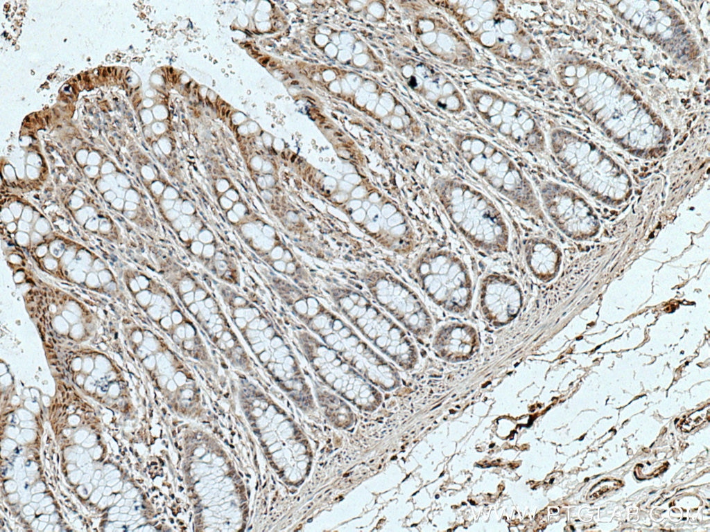 Immunohistochemistry (IHC) staining of human colon tissue using HPGD Monoclonal antibody (66798-1-Ig)