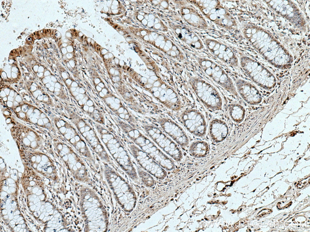 IHC staining of human colon using 66798-1-Ig