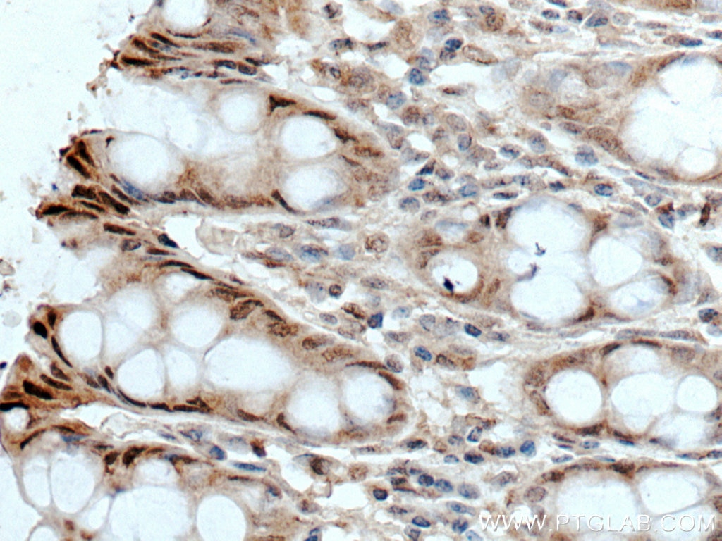 Immunohistochemistry (IHC) staining of human colon tissue using HPGD Monoclonal antibody (66798-1-Ig)