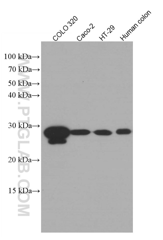 Western Blot (WB) analysis of various lysates using HPGD Monoclonal antibody (66798-1-Ig)