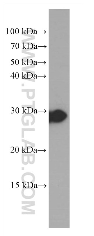 Western Blot (WB) analysis of human small intestine tissue using HPGD Monoclonal antibody (66798-1-Ig)