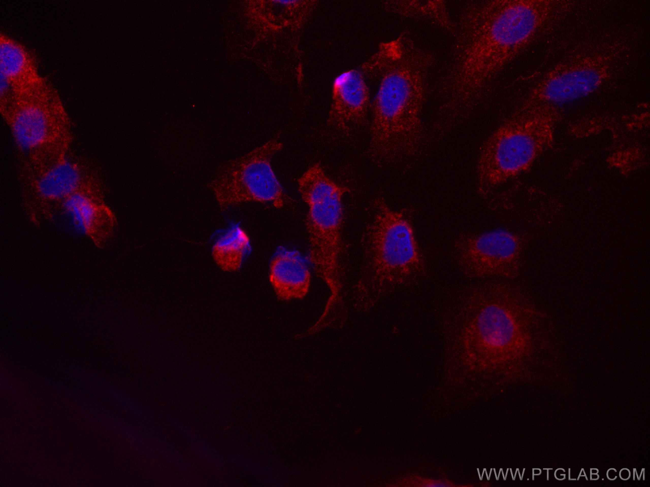 Immunofluorescence (IF) / fluorescent staining of A549 cells using CoraLite®594-conjugated HPGD Monoclonal antibody (CL594-66798)