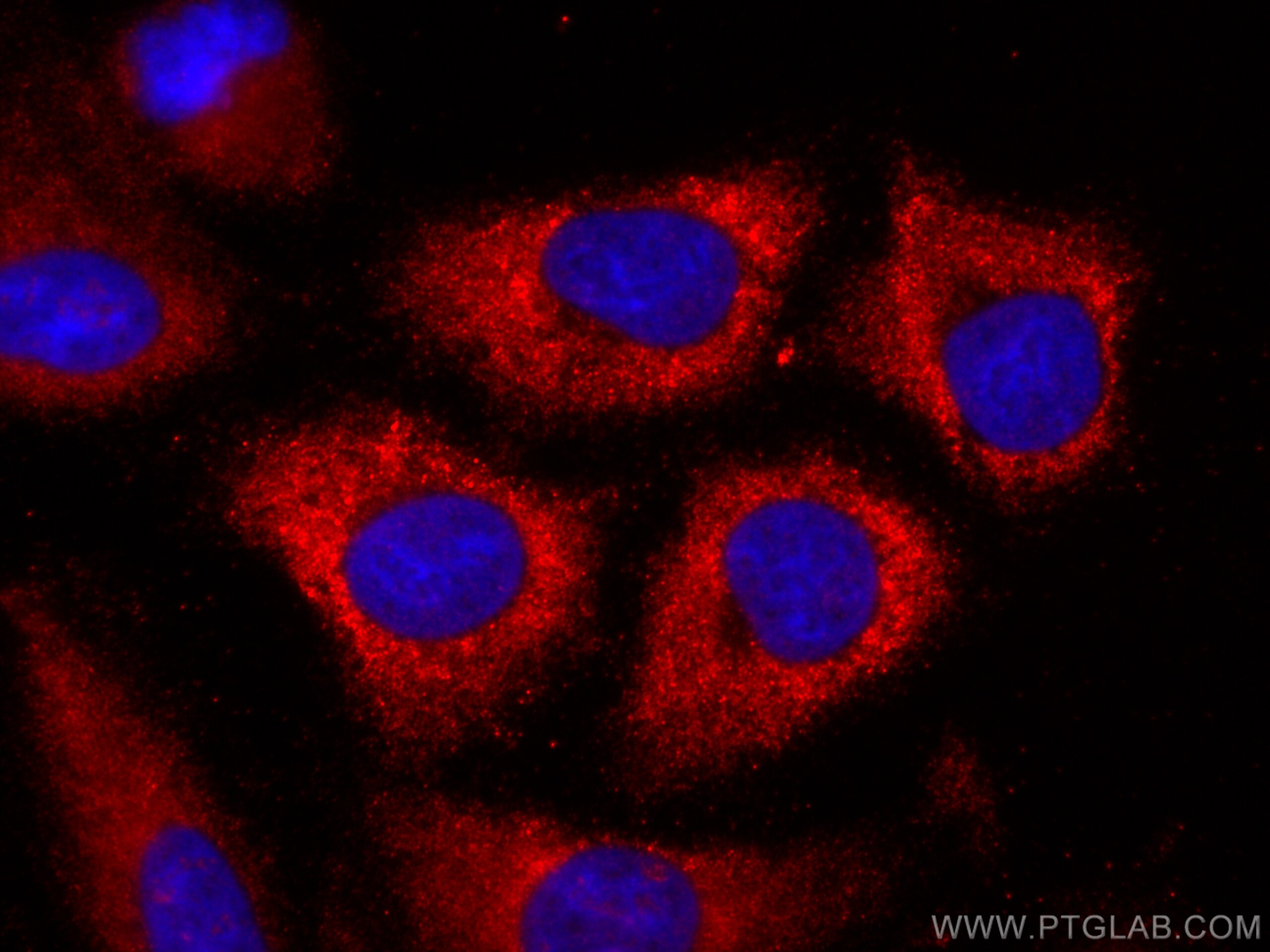 Immunofluorescence (IF) / fluorescent staining of A549 cells using CoraLite®594-conjugated HPGD Monoclonal antibody (CL594-66798)