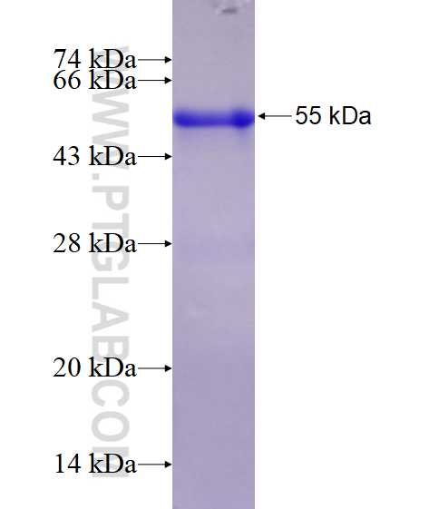 HPGD fusion protein Ag1499 SDS-PAGE