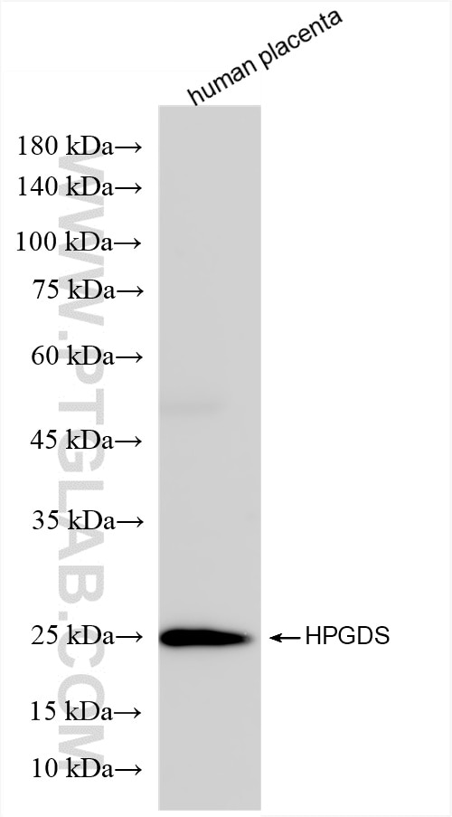 Western Blot (WB) analysis of human placenta tissue using HPGDS Recombinant antibody (85446-2-RR)