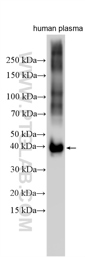 Various lysates were subjected to SDS PAGE followed by western blot with 33434-1-AP (HPR antibody) at dilution of 1:40000 incubated at room temperature for 1.5 hours. Western Blot (WB) analysis of various lysates using HPR Polyclonal antibody (33434-1-AP)
